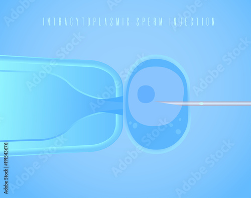 Intracytoplasmic Sperm Injection, in vitro fertilization, icsi process. Vector Illustration for web, typography magazine, medical brochure, flyer, poster.