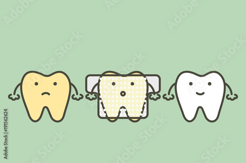 yellow tooth used teeth whitening strip