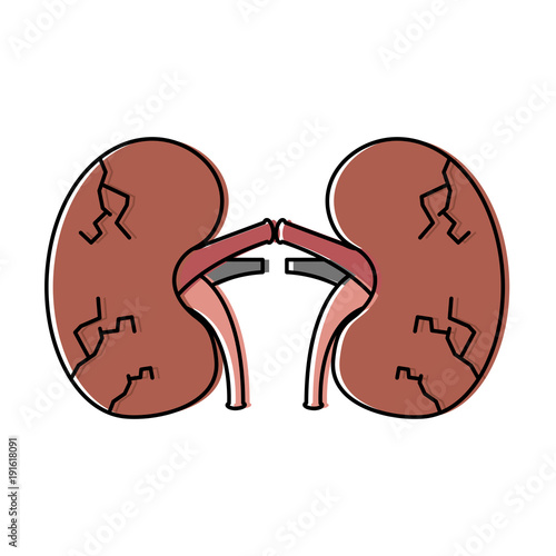 kidneys human unhealthy disease medical anatomic damaged vector illustration 