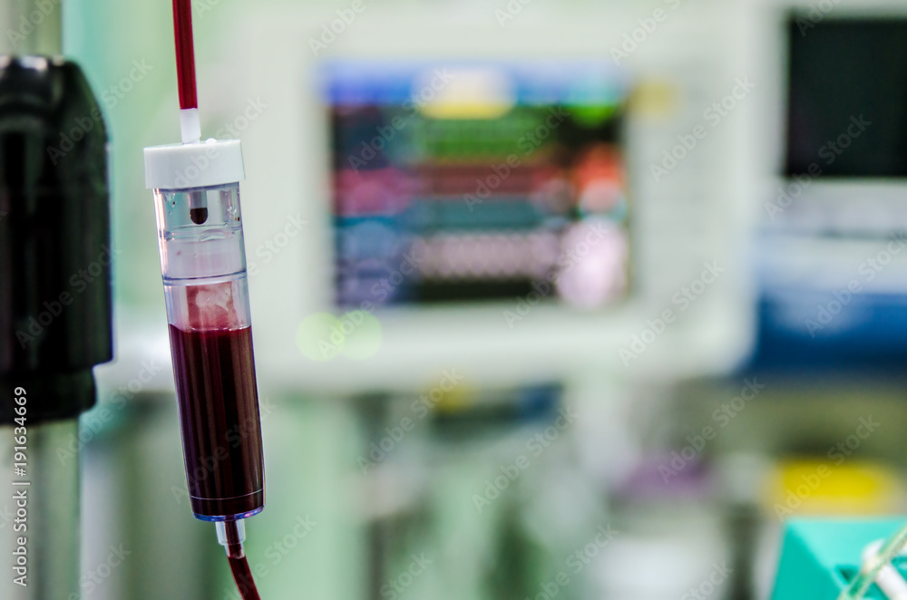 A dropper with blood in the operating room on the background of the monitor with indicators of the patient's life.
