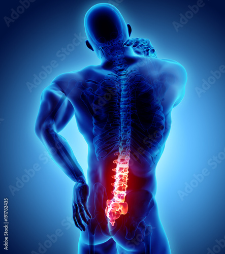 3D Illustration of sacral spine painful.