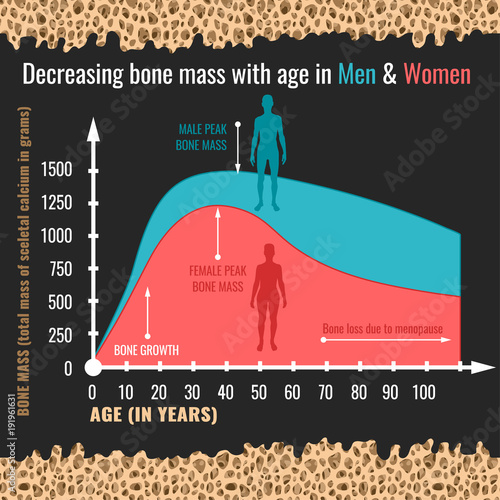 Decreasing bone mass 