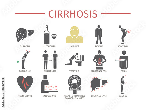 Cirrhosis. Symptoms, Treatment. flat icons set photo