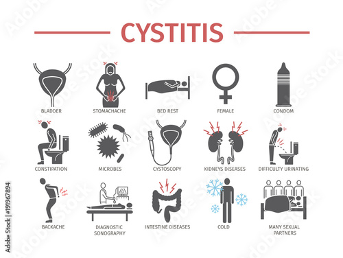 Cystitis. Symptoms, Treatment.