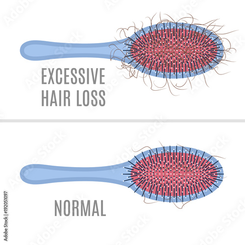 Brush with hair tuft as a sign of alopecia and comb without a clump. Beauty healthcare concept. Vector illustration.