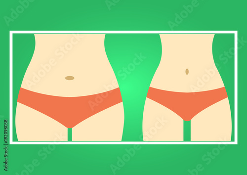 Fat and slim woman figure, before and after weight loss. Female body silhouette. Women waist, weight loss, diet, waistline line icon. Vector illustration
