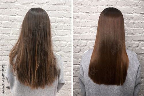 Quadro su tela Sick, cut and healthy hair. Hair before and after treatment.