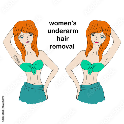 Cartoon beauty woman do epilation before and after. Concept of women's underarm hair removal. Unwanted hair, superfluous hair.