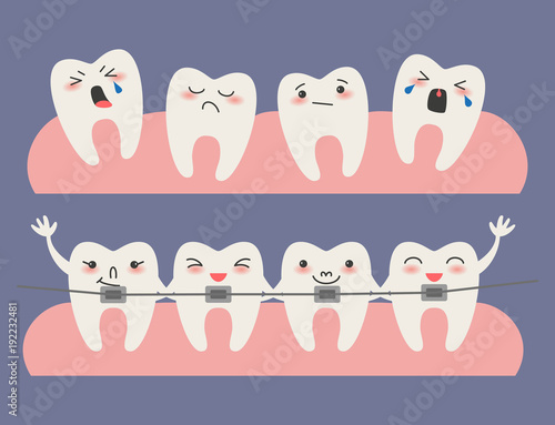 Cartoon Teeth with braces on blue background.