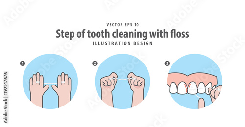 Step of tooth cleaning with floss illustration vector on blue background. Dental concept.