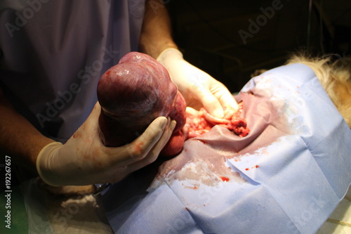 Quadro em tela Hysterectomy uterine cancer by American Cocker Spaniel