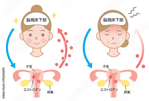 更年期障害　エストロゲン