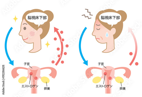 更年期障害　エストロゲン