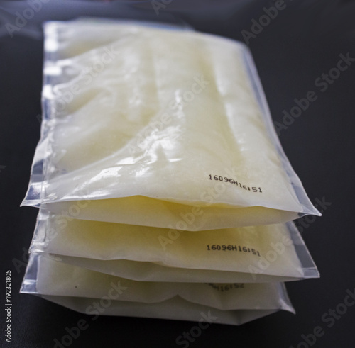 Pumped frozen breastmilk for feeding baby