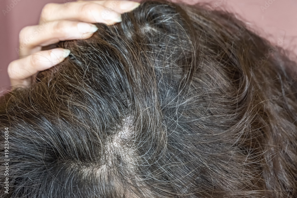 Woman shows her gray hair roots. Going gray. Woman shows her gray hair roots. Going gray.