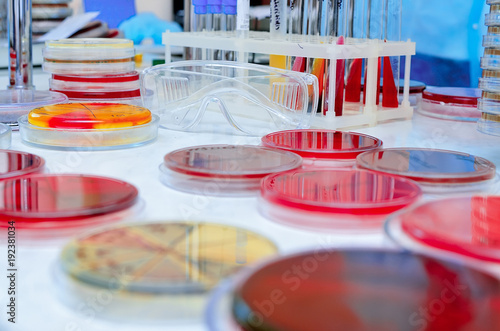 Petri dish. Microbiological laboratory. Mold and fungal cultures. Bacterial research photo