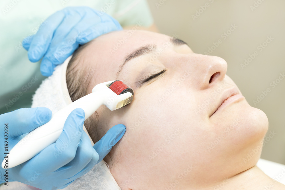 The woman undergoes the procedure of medical micro needle therapy with a modern medical instrument derma roller The woman undergoes the procedure of medical micro needle therapy with a modern medical instrument derma roller