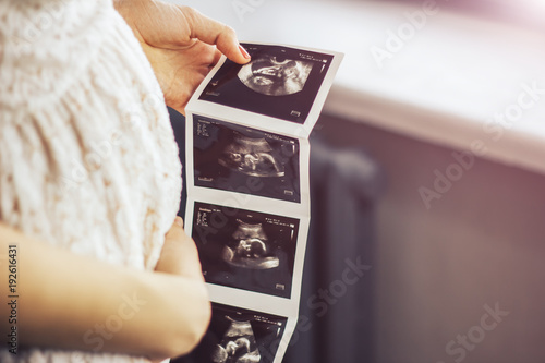 Foto Pregnant girl holding photos of ultrasound result in hands, near window with sun