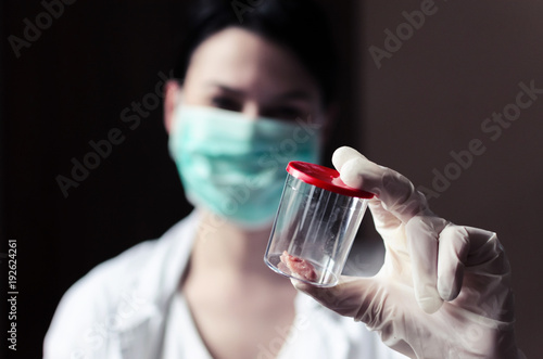 Foto sample of tumors or cancers in the container