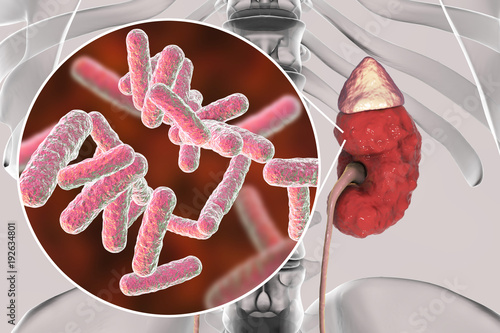 Pyelonephritis, medical concept, and close-up view of bacteria, causative agent of kidney infection, 3D illustration photo