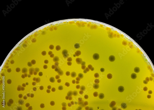 Closeup for plate Bacteria culture growth on Selective media, vibrio spp