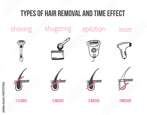 Types of hair removal with follicle infographics in flat linear style.  Epilation treatment for women vector de Stock | Adobe Stock