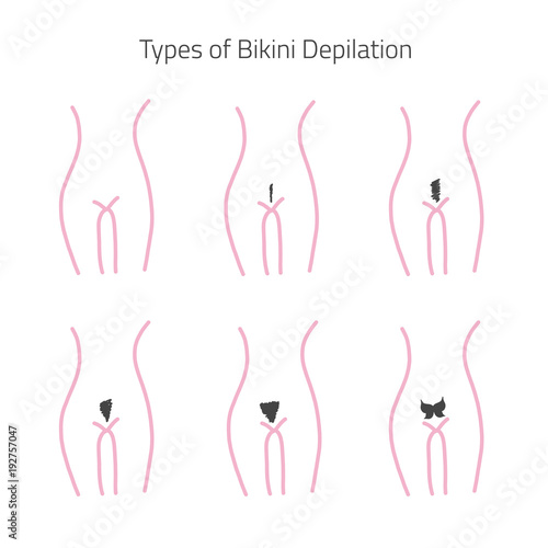 Types of bikijni hair removal in flat linear style. Can be used for infographics, banners
