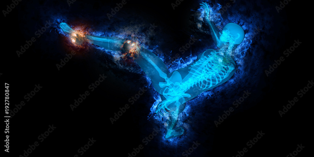 Artistic illustration of a man kicking while having pain in his joints