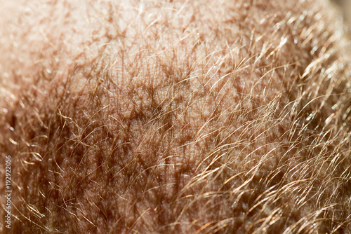 human skin texture