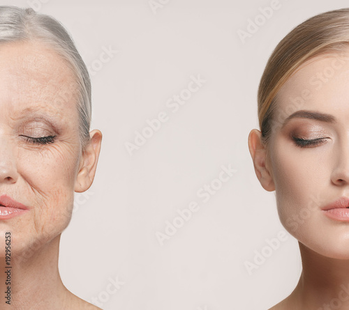 Comparison. Portrait of beautiful woman with problem and clean skin, aging and youth concept, beauty treatment photo