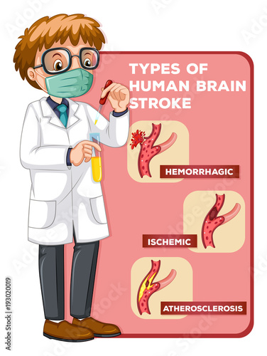 Doctor and diagram showing human brain strokes