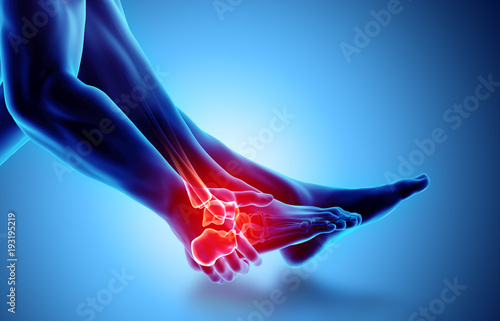 Ankle painful - skeleton x-ray.