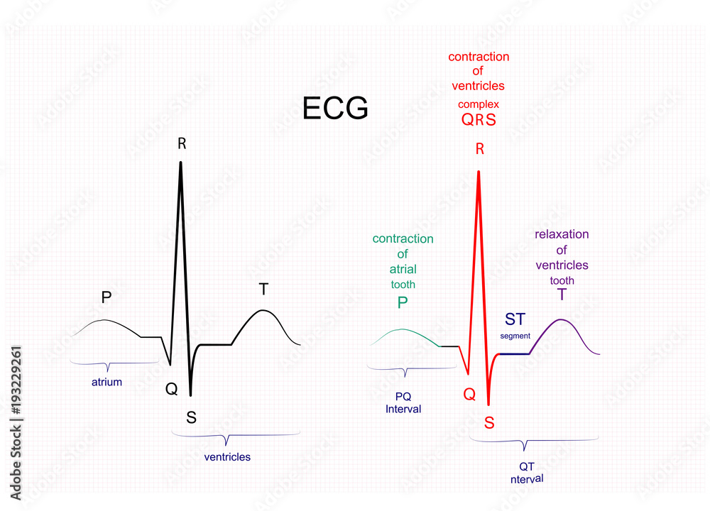 the ECG interpretation Adobe Stock