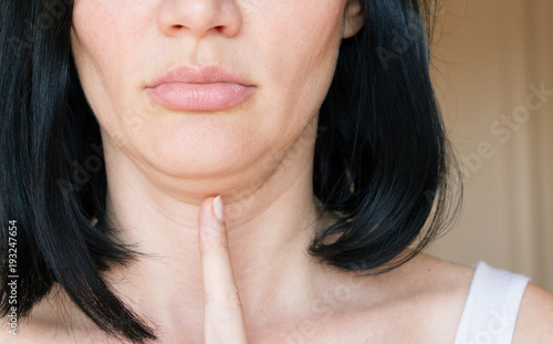 Foto double chin. face line correction