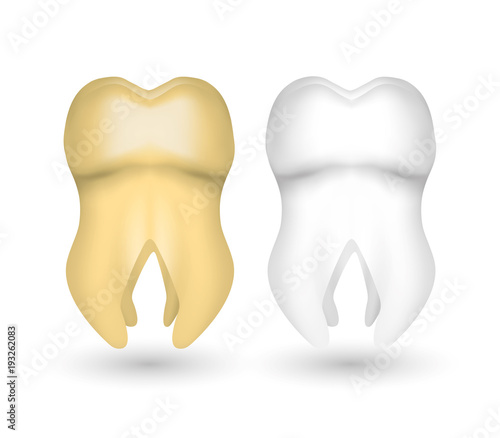 Set of clean and dirty tooth