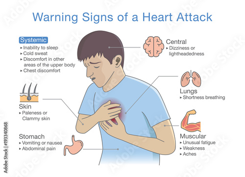 Diagram about warning signs of a heart attack. Illustration about disease symptoms when occurring.