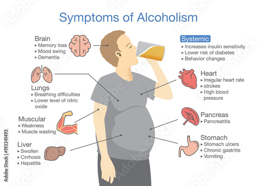 Symptom of alcoholism patient. Illustration about health problem of people with alcohol addiction.