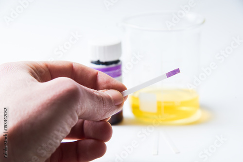 urine test for acetone