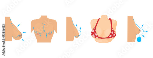 Breast icon set, cartoon style