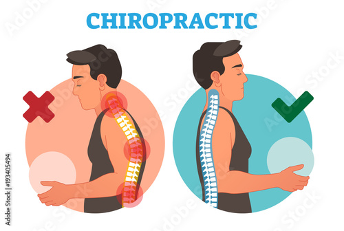 Chiropractic conceptual vector illustration with back bone curvature. 
