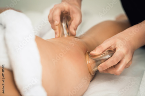 Anti-cellulite massage of the hips with the use of vacuum cans (jars, banks).