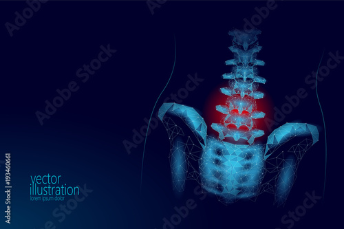 Human spine hip lumbar radiculitis pain low poly. Geometric polygonal particle triangle point line future medicine technology blue red painful area vector illustration