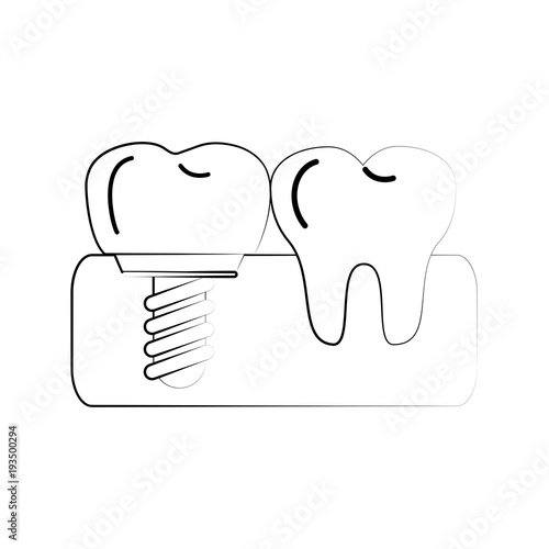 Tooth implant odontology icon vector illustration graphic design