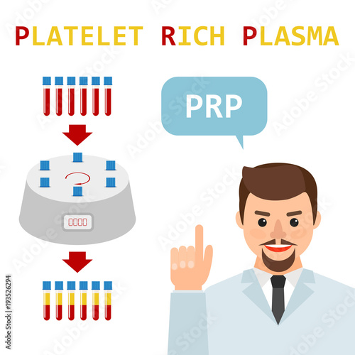 Platelet rich plasma. PRP method. Vector.