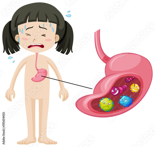 sick girl with stomach and germs clip art preview