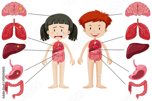 Girl and boy with different healthy and unhealthy body