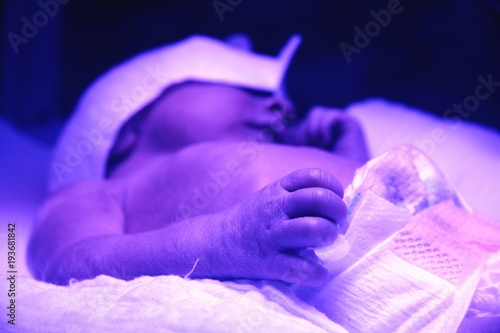Behandlung eines Frühchen Babys mit Neugeborenenfieber