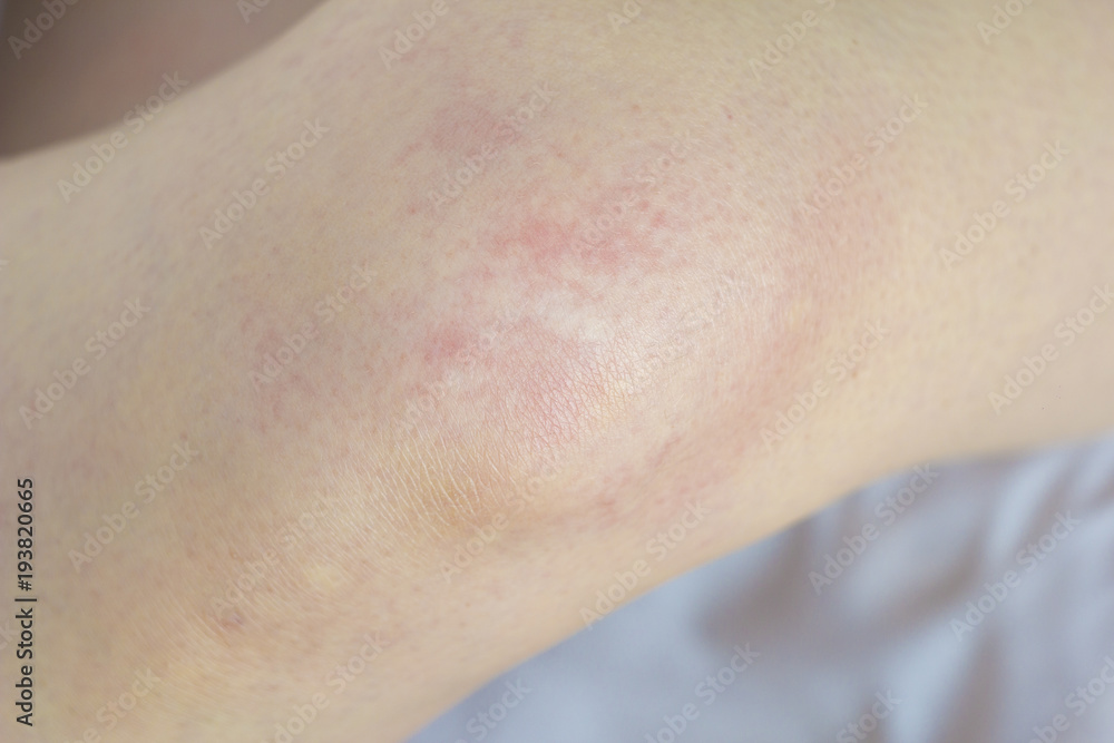 Fototapeta premium Kneeling, female legs of the knees