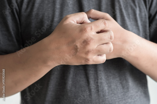 itchy arms scratching Healthcare And Medicine Health problem