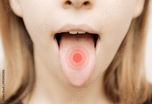 Lingua arrossata, bocca aperta con bollo rosso photo